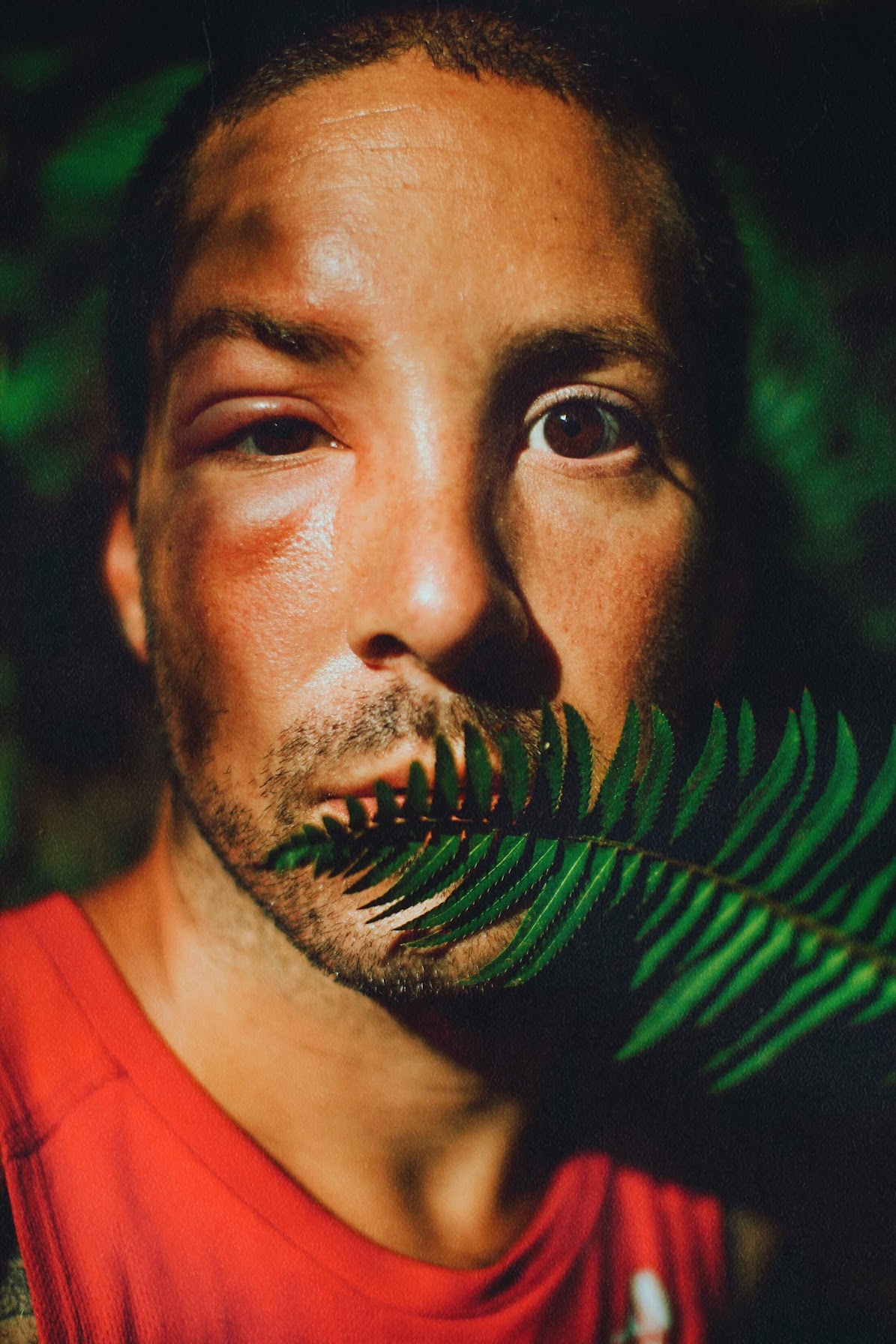 Tommy Corey self portrait of a man with a swollen eye behind a fern.
